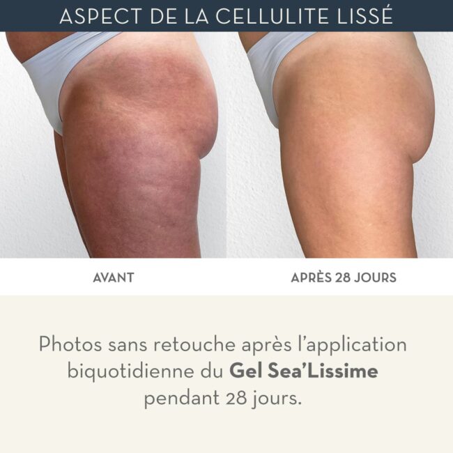 gel minceur jambes